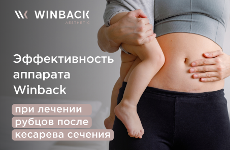 Эффективность аппарата Winback при лечении рубцов после кесарева сечения